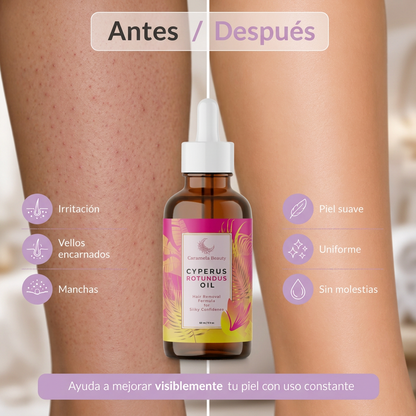 ACEITE DEPILACIÓN